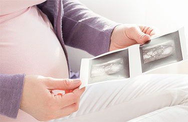 Donor Egg Success Rates